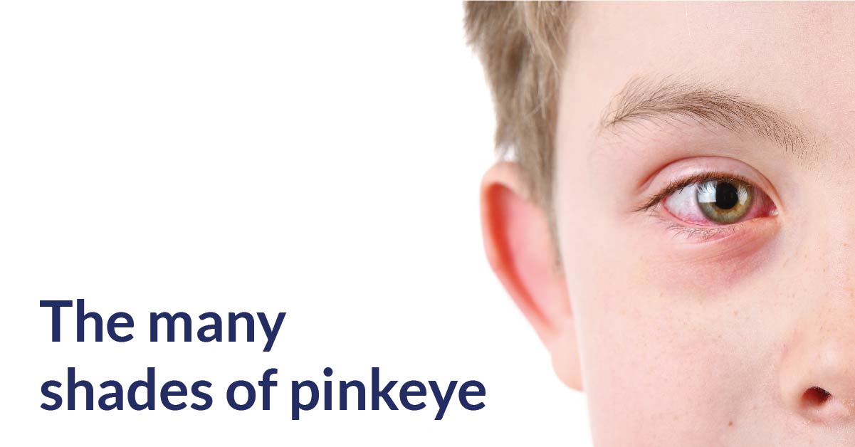 Pink Eye — Middlesex-London Health Unit
